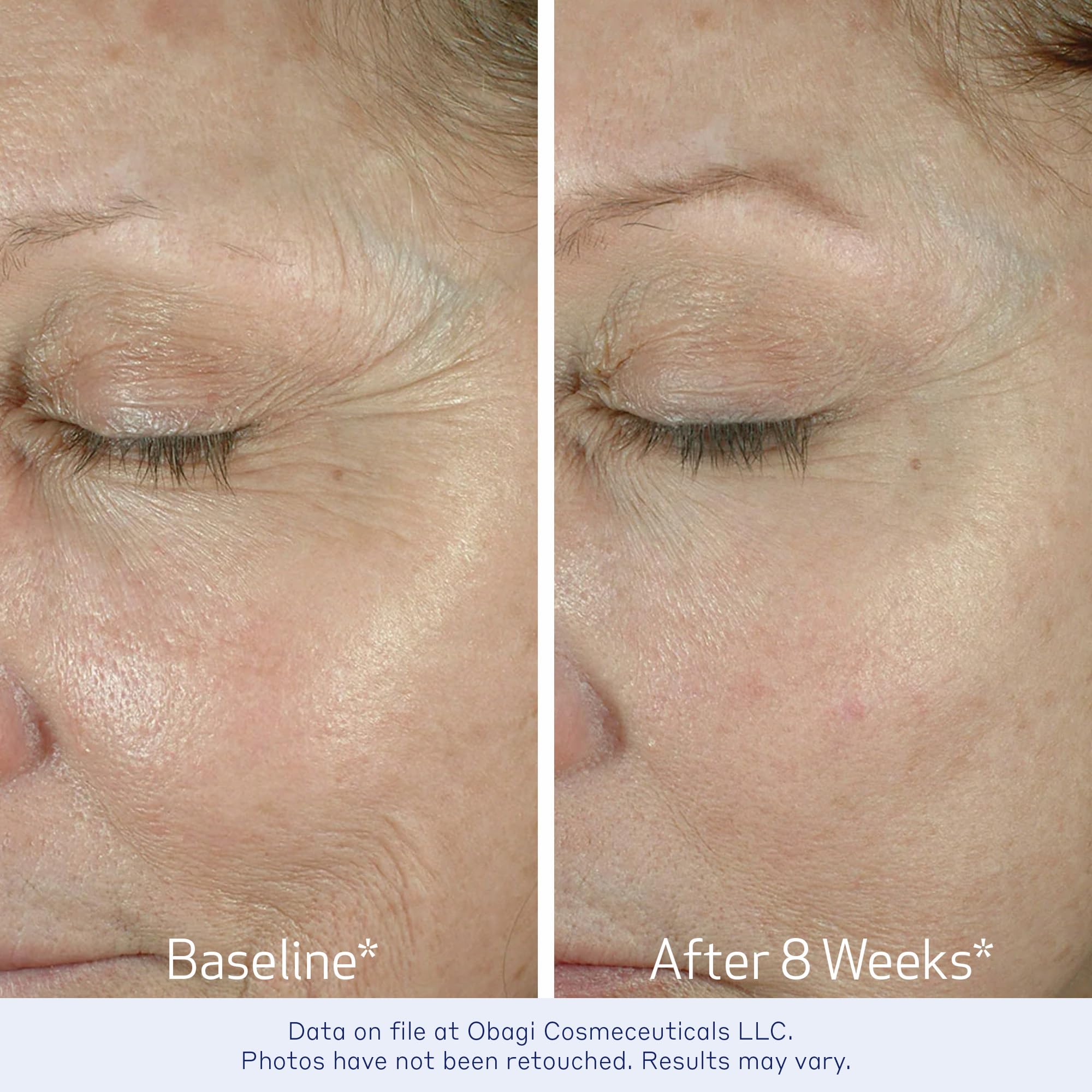 Obagi ELASTIderm Eye Cream – Lightweight, Smooth Formula Clinically Proven to Help Reduce the Appearance of Fine Lines & Wrinkles